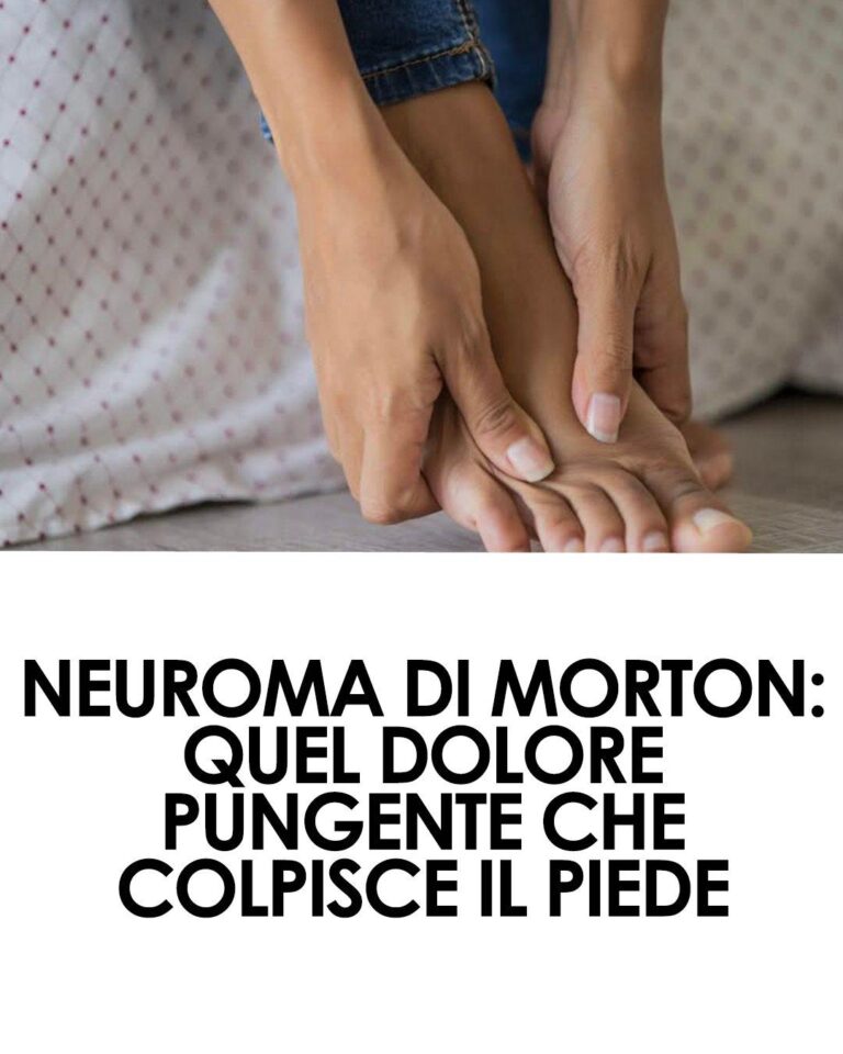 Neuroma di Morton: quel dolore pungente che colpisce il piede
