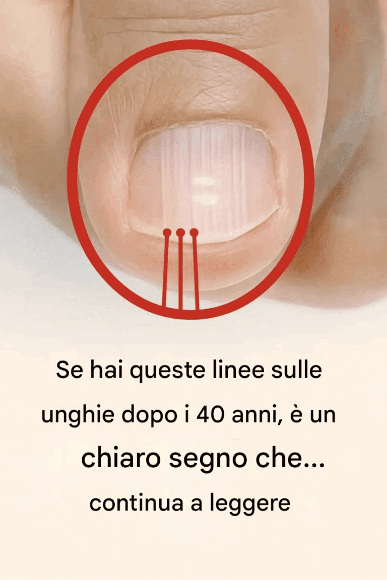 Le Tue Unghie Dopo i 40 Anni: Cosa Rivelano Sulla Tua Salute