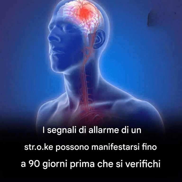 I segnali di allarme S.tro.ke possono comparire già 90 giorni prima dell'evento